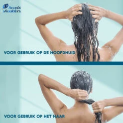 6x Head & Shoulders Conditioner DERMAxPRO 11 6x Head & Shoulders Conditioner DERMAxPRO -Cosmetica Discountwinkel 1068946 6